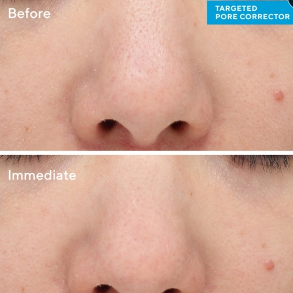 NWOB MURAD TARGETED PORE CORRECTOR - Picture 8 of 15